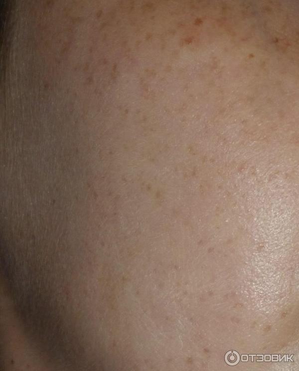 Крем-барьер от загара, веснушек и пигментации Floresan SPF 30 фото