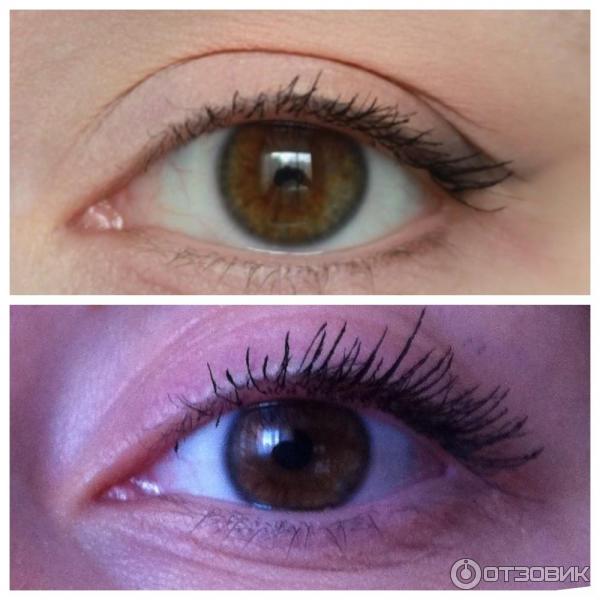 xlash фото отзыв до и после