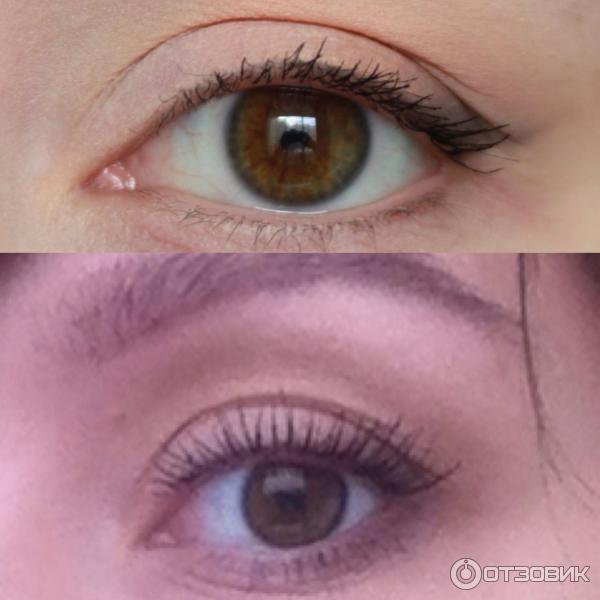 xlash фото отзыв до и после