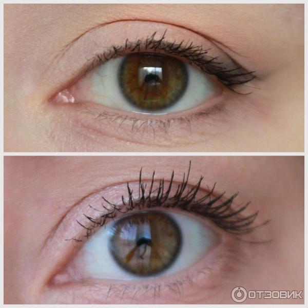 xlash фото отзыв до и после