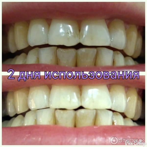 Зубная паста Экстра белизна Blanx Oral Care фото