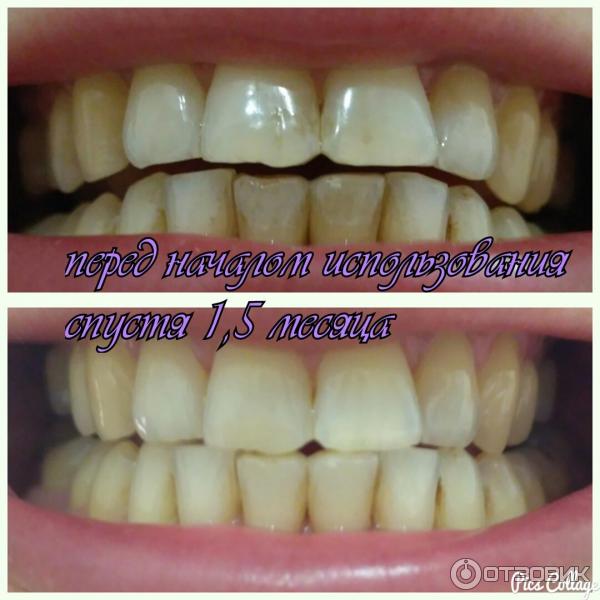 Зубная паста Экстра белизна Blanx Oral Care фото