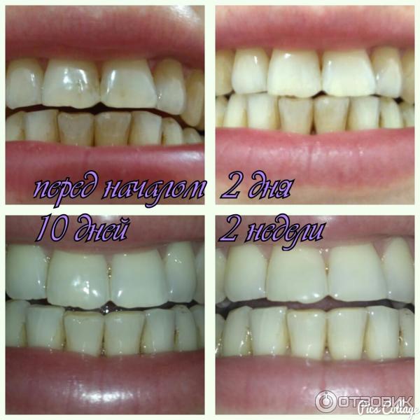 Зубная паста Экстра белизна Blanx Oral Care фото