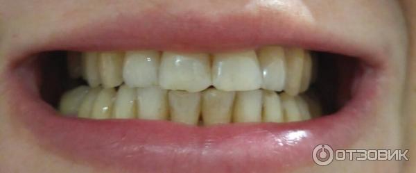 Зубная паста Экстра белизна Blanx Oral Care фото
