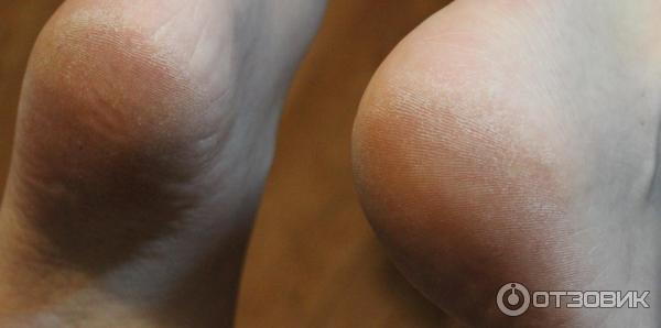 Крем для ног Aravia Professional Super Moisture от натоптышей с мочевиной фото