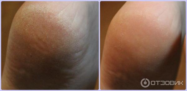 Крем для ног Aravia Professional Super Moisture от натоптышей с мочевиной фото