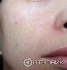 Тоник для лица Bielita-Вiтэкс Retinol+Mg Коррекция морщин фото