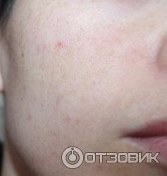 Тоник для лица Bielita-Вiтэкс Retinol+Mg Коррекция морщин фото