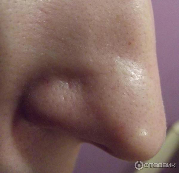 Полоски для глубокого очищения кожи лица Purederm фото