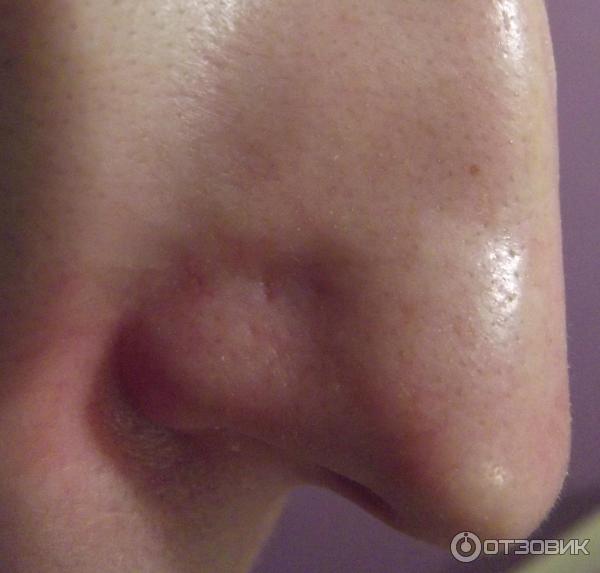 Полоски для глубокого очищения кожи лица Purederm фото