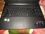 Ноутбук Lenovo IdeaPad 100-15 фото