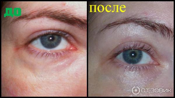 Антивозрастной крем для век со змеиным ядом Premium Syn-Ake Anti-Wrinkle Eye Cream фото