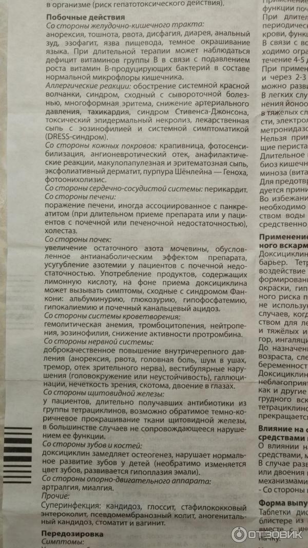 Отзыв о Препарат Синтез Доксициклин капсулы работает