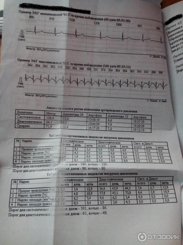 Метод диагностики Суточное мониторирование артериального давления (СМАД) фото